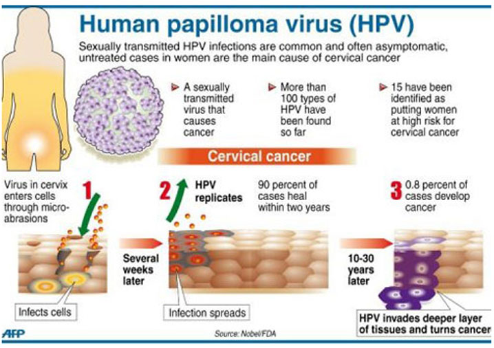 宫颈癌自述，HPV病毒是最大祸因！